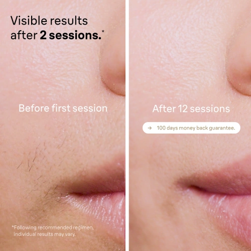 Фотоэпилятор Braun Silk-expert Pro 5 PL5242 — фото, купить в Минске с доставкой по Беларуси — 360shop.by