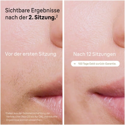 Фотоэпилятор Braun Silk-expert Pro 5 PL5140 — фото, купить в Минске с доставкой по Беларуси — 360shop.by